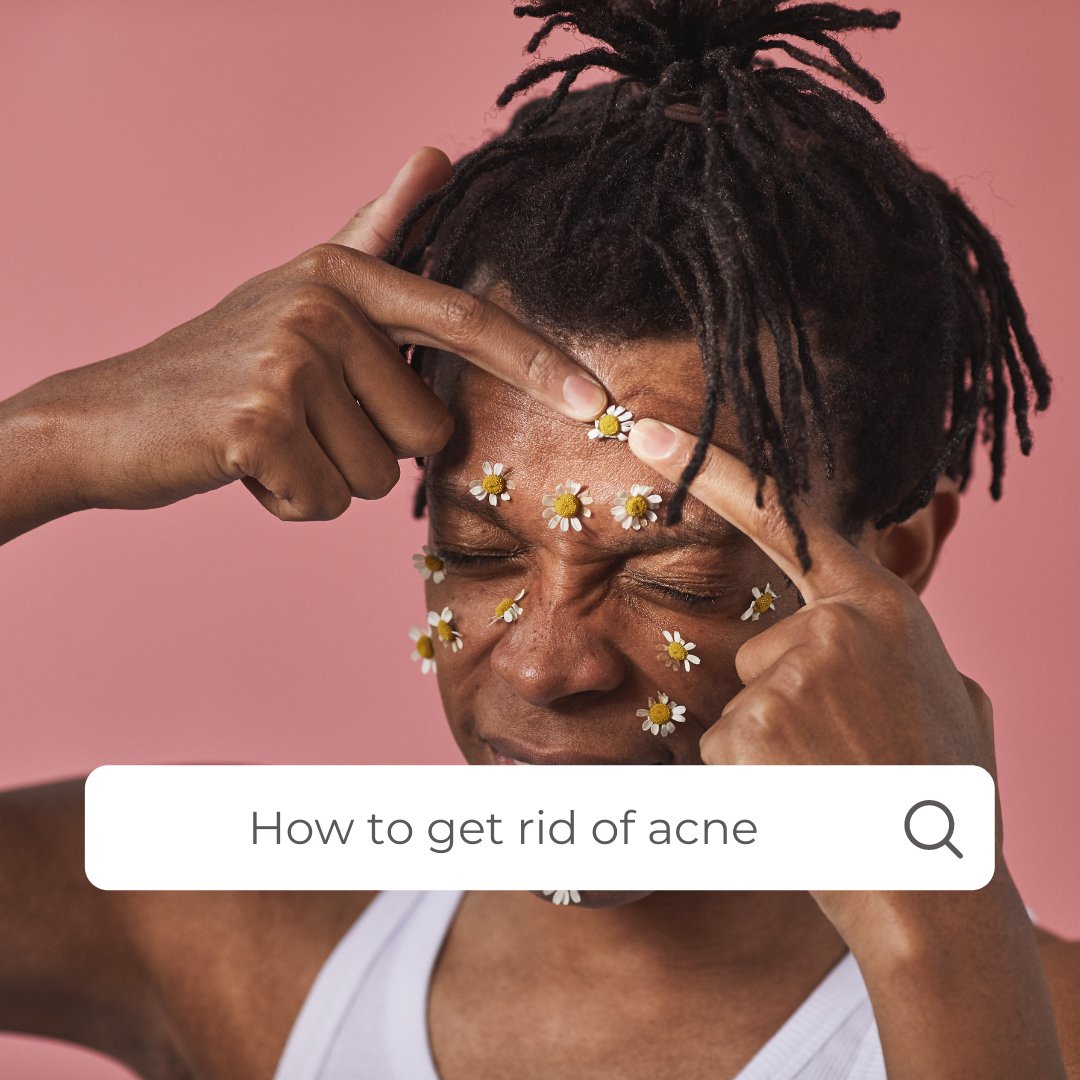 How to get rid of acne